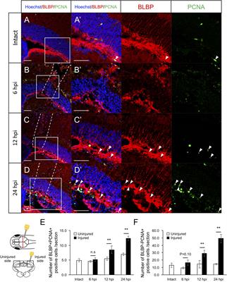 Transcriptome Analyses Reveal IL6/Stat3 Signaling Involvement in Radial Glia Proliferation After Stab Wound Injury in the Adult Zebrafish Optic Tectum